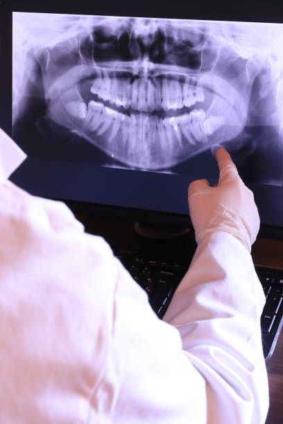 Best Emergency Tooth Extraction in Olympia, SC
