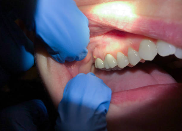 Best After-Hours Emergency Dentist in Olympia, SC