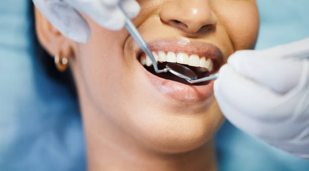 Best Emergency Tooth Extraction in Olympia, SC